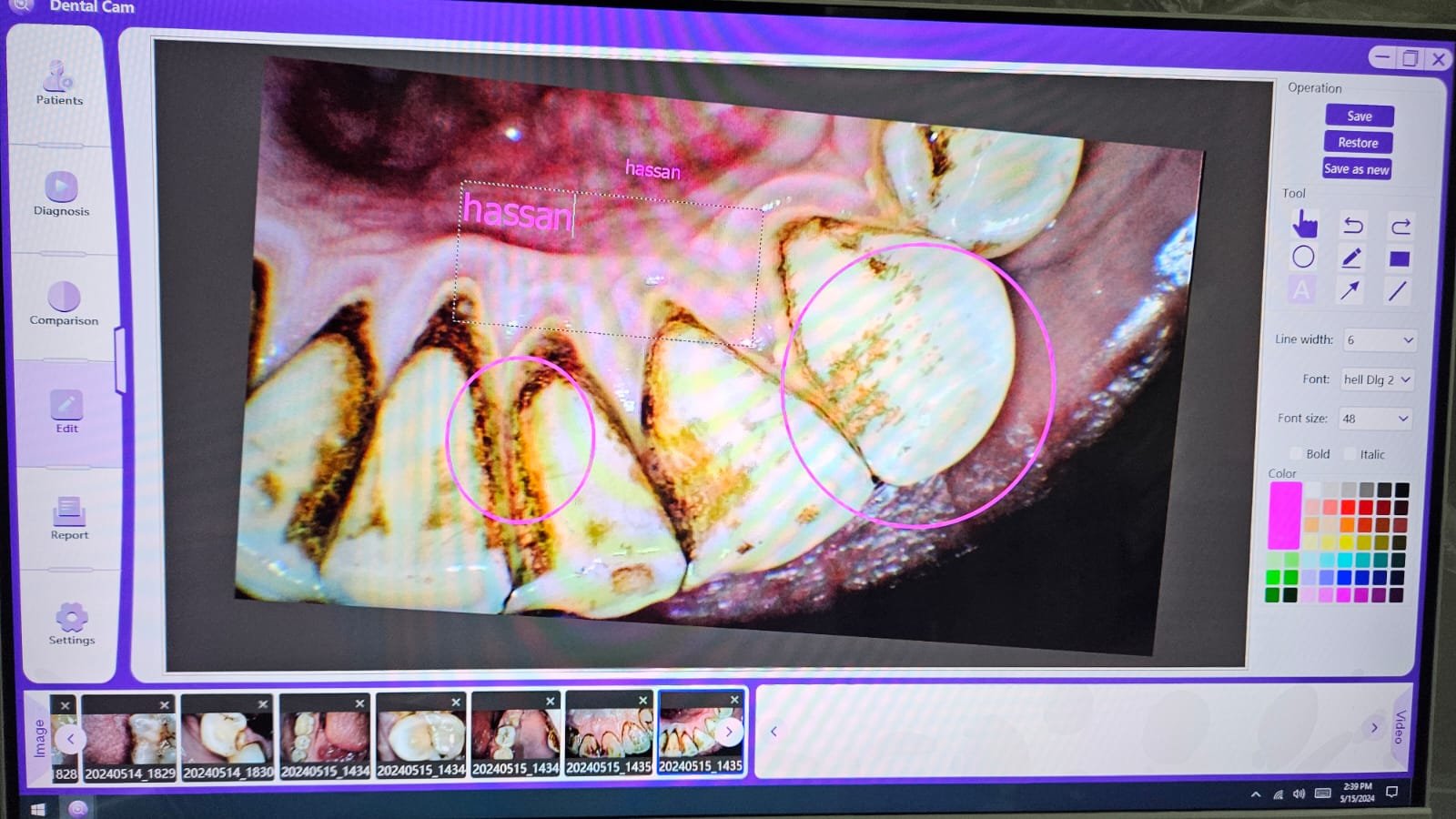 BND-X6 Touch-type All-in-One Computer Intelligent Oral Observation Instrument.
